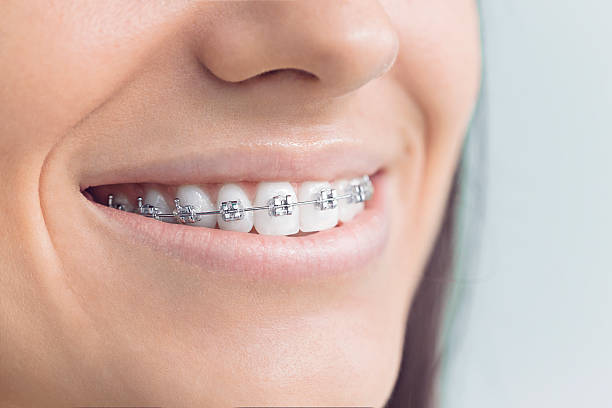Dental Inlays and Onlays in Mentor, OH